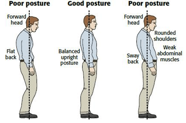 Man showing slouched posture contributing to shoulder impingement vs good posture