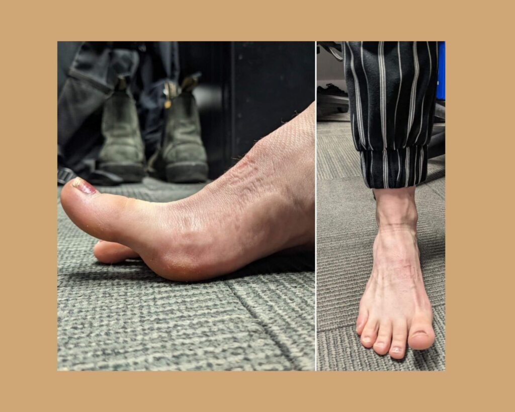 Big Toe Lift exercise to strengthen foot