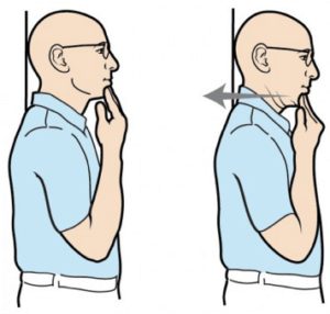 Chin Tucks Exercise for Chronic Neck Pain