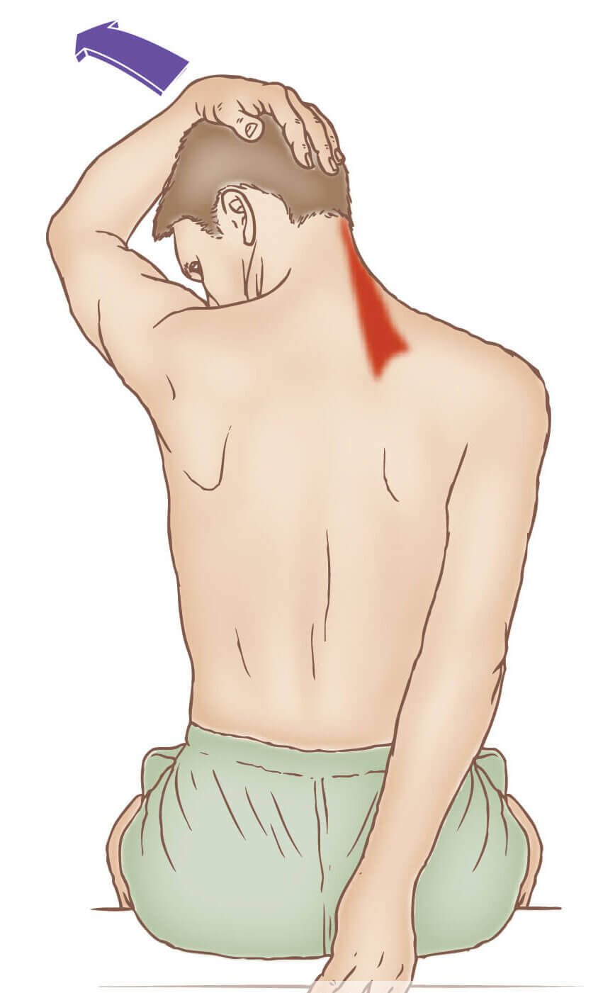 Levator Scapulae Stretch for Chronic Neck Pain