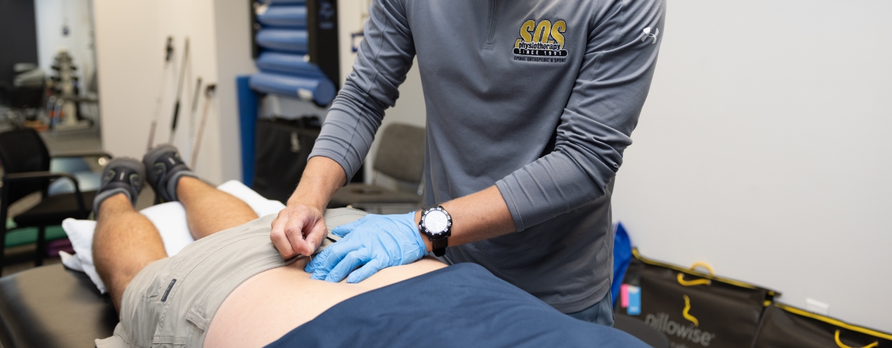 Dry needling to treat muscle pain - Mayo Clinic Health System