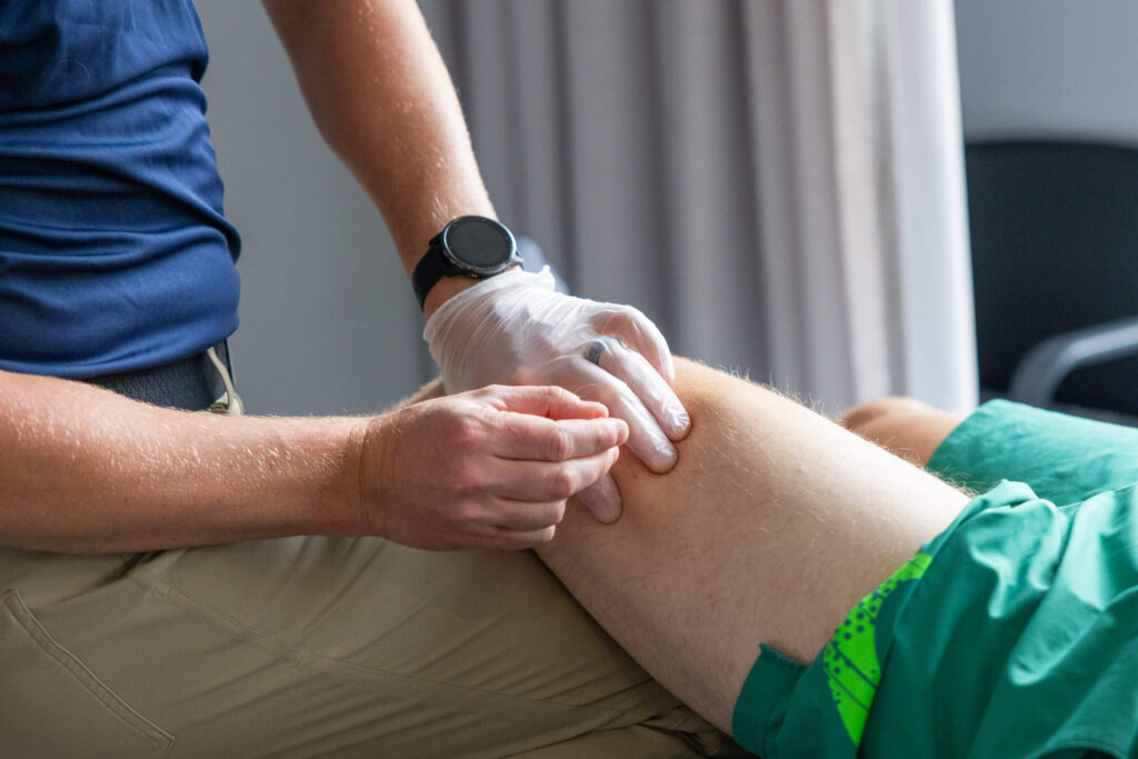 Physiotherapist Dry Needling a Patient's Knee