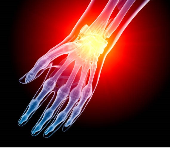 Wrist pain from golf