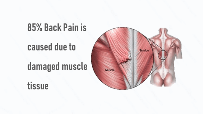 Back Pain Symptom