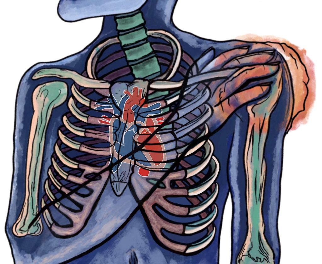 Colored skeleton holds left shoulder radiating red with pain for injury prevention in shoulders