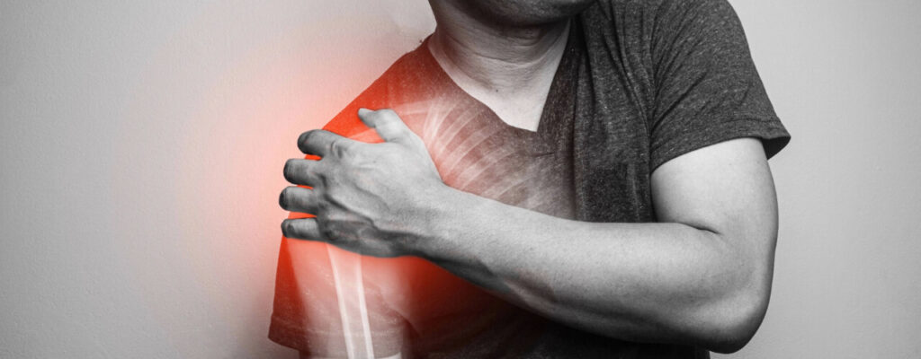 How Physiotherapy Helps with Shoulder Impingement Treatment