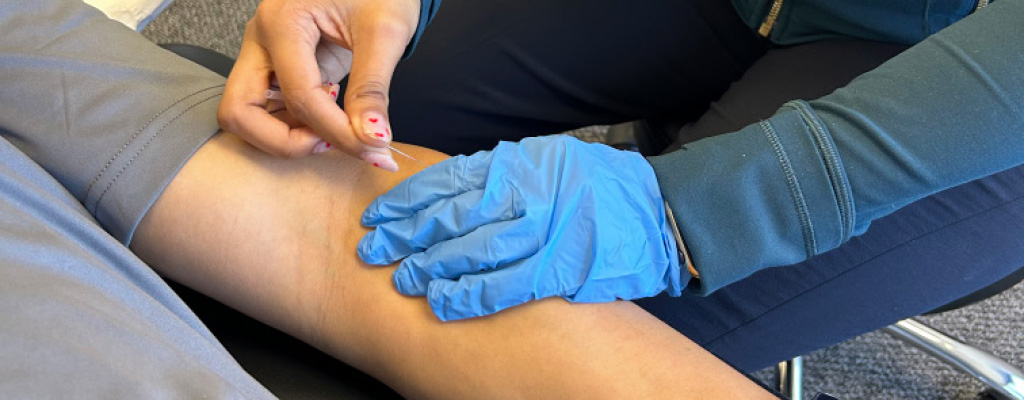 Advancing Clinical Practice: My Introduction to Acupuncture and Dry Needling
