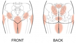 Pregnancy-related pelvic pain distribution. Highlighted inner thighs, hips, pubis symphysis, hip joint, sacroiliac joint.