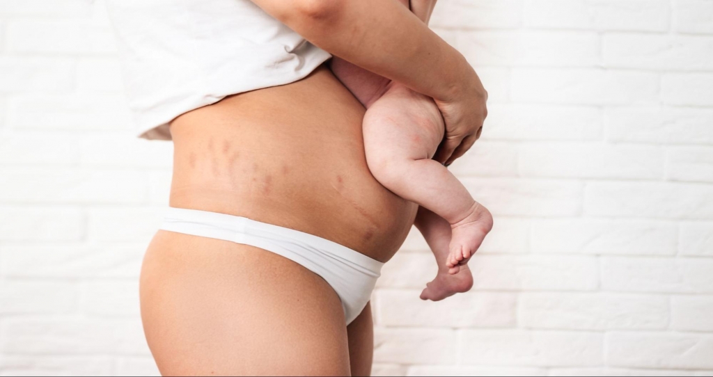 Post-partum woman holds a baby over her stomach